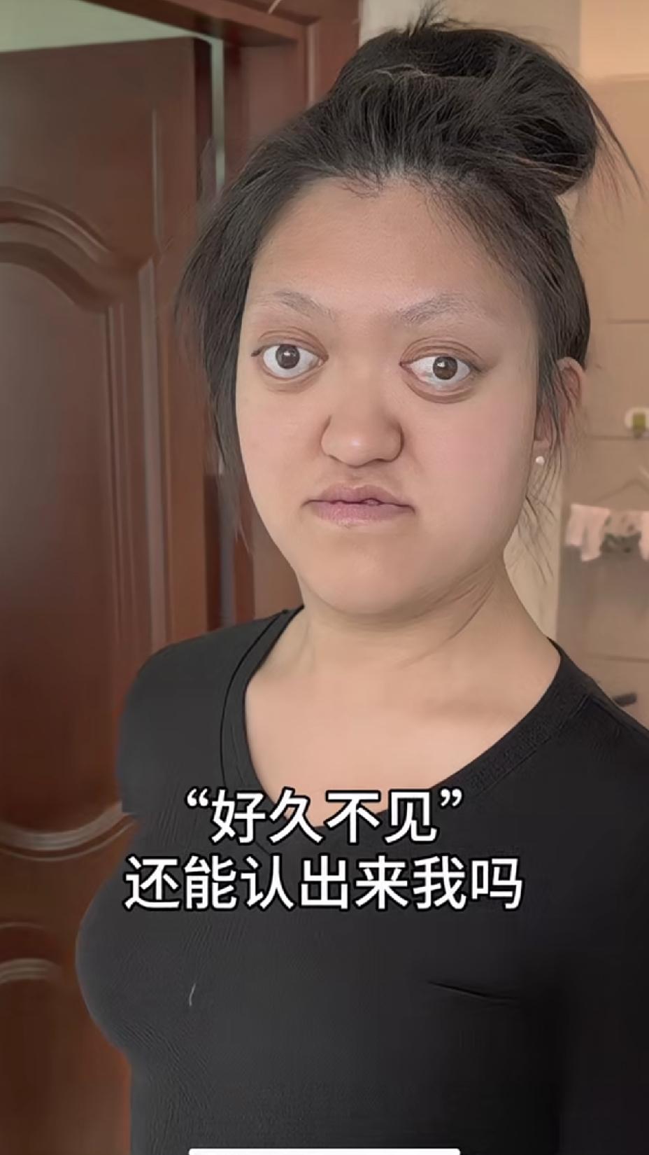 整容的太成功了，以前那么丑，现在美的都认不出来了。