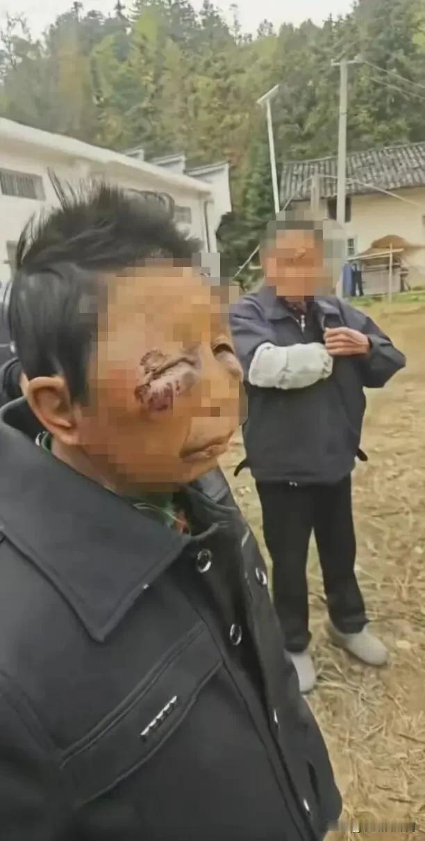 七旬相伴，竟挥拳脚？平江这场晚年家暴戳痛人心湘北的冬日透着刺骨的凉，可比寒