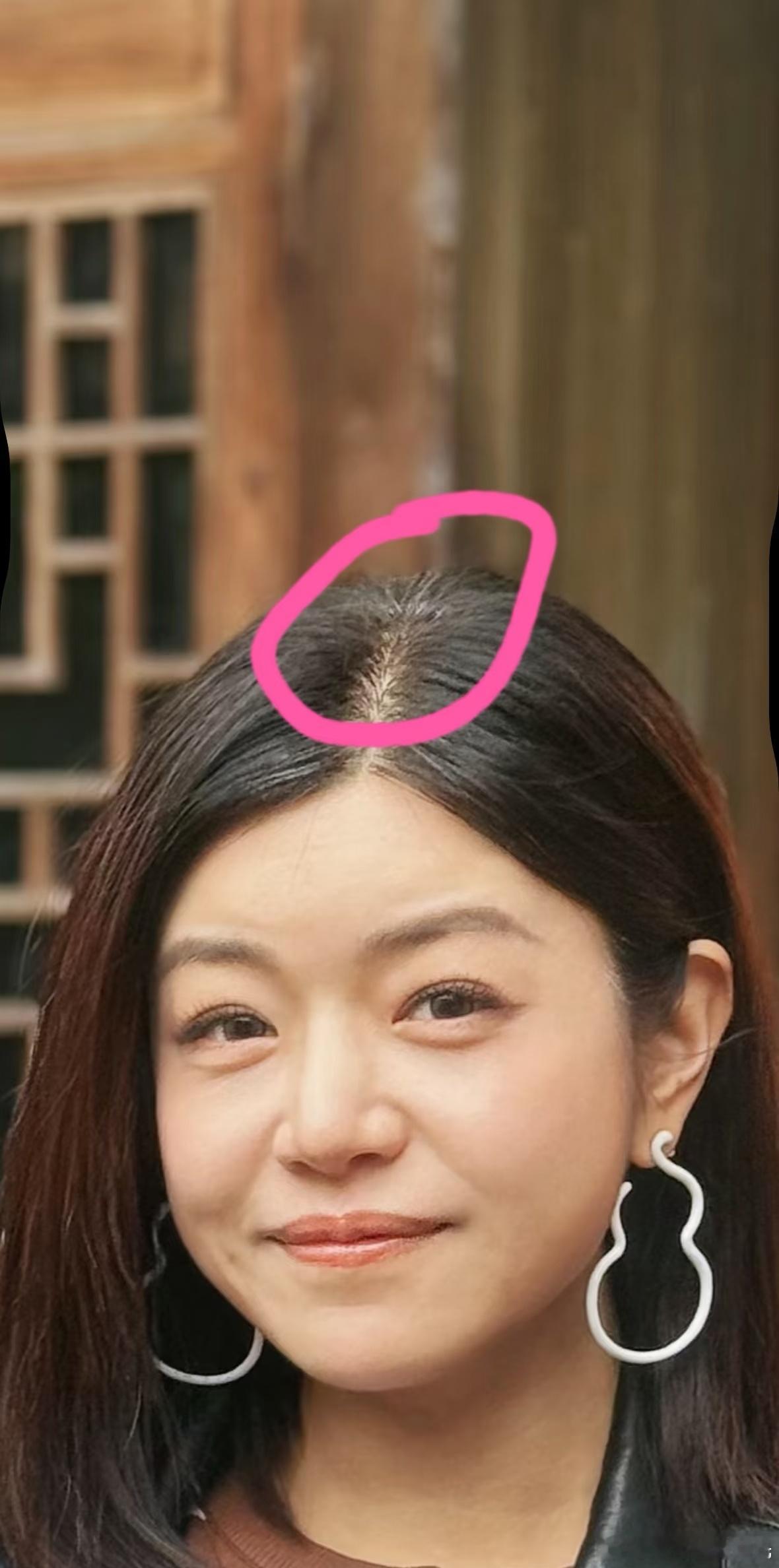 陈妍希白发42岁陈妍希有白发了网友偶遇陈妍希并合影，po上网以后其他网友发现4