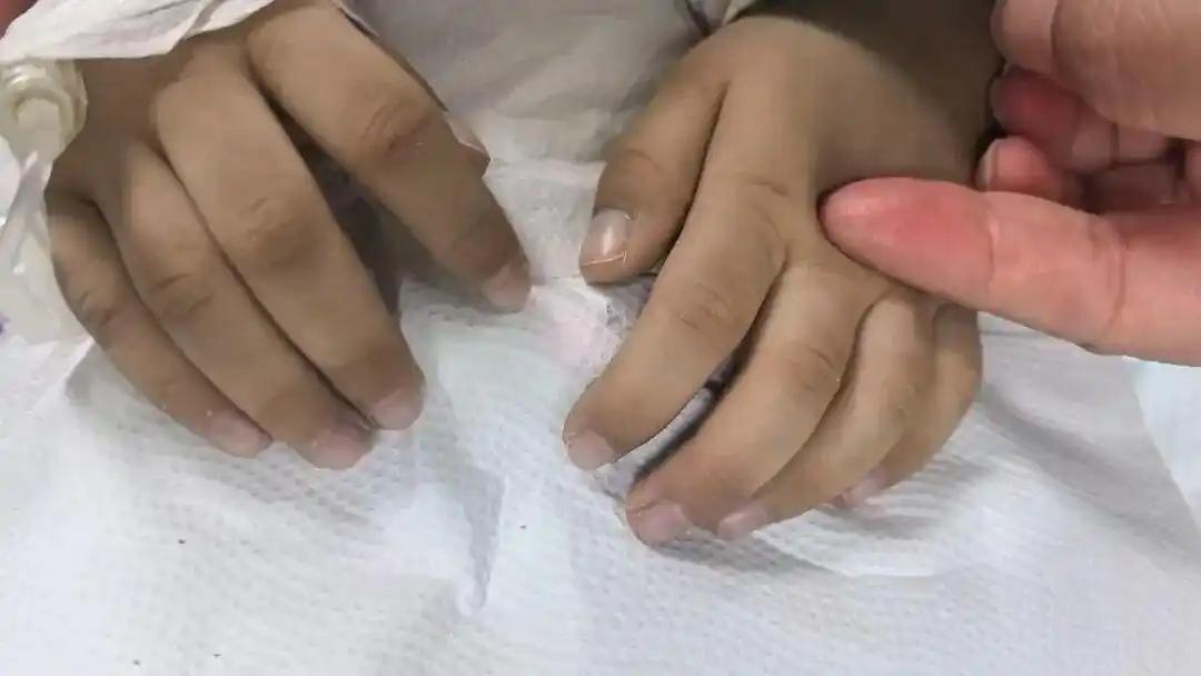 广东佛山，3岁男孩在幼儿园被老师发现脸色、唇色莫名发青发紫。家长起初不以为意，认
