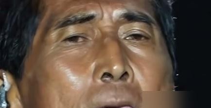 64岁的齐秦因长期嚼槟榔导致满口真牙烂透，最终赴美种植24颗假牙，还因肺炎支原体感染被误传成肺癌晚期