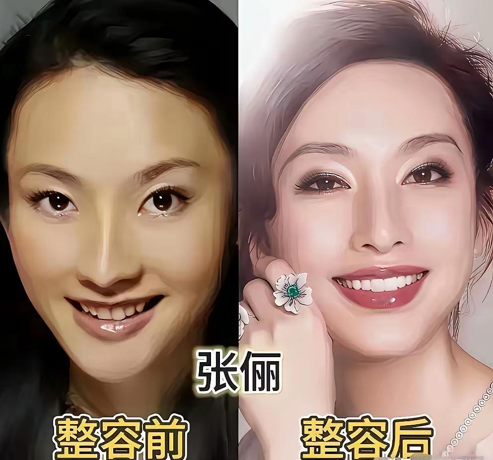 不少女星只做轻微调整，颜值提升却肉眼可见，恰到好处堪称整容范本。如今医美早已普