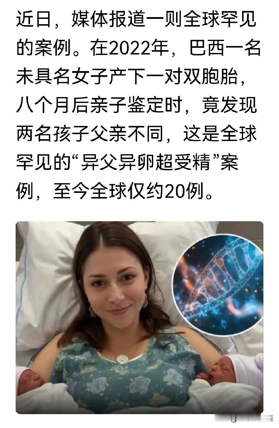 “物以稀为贵”，巴西女子把稀有这词玩到了新高度。生个双胞胎不足为奇在当今世界