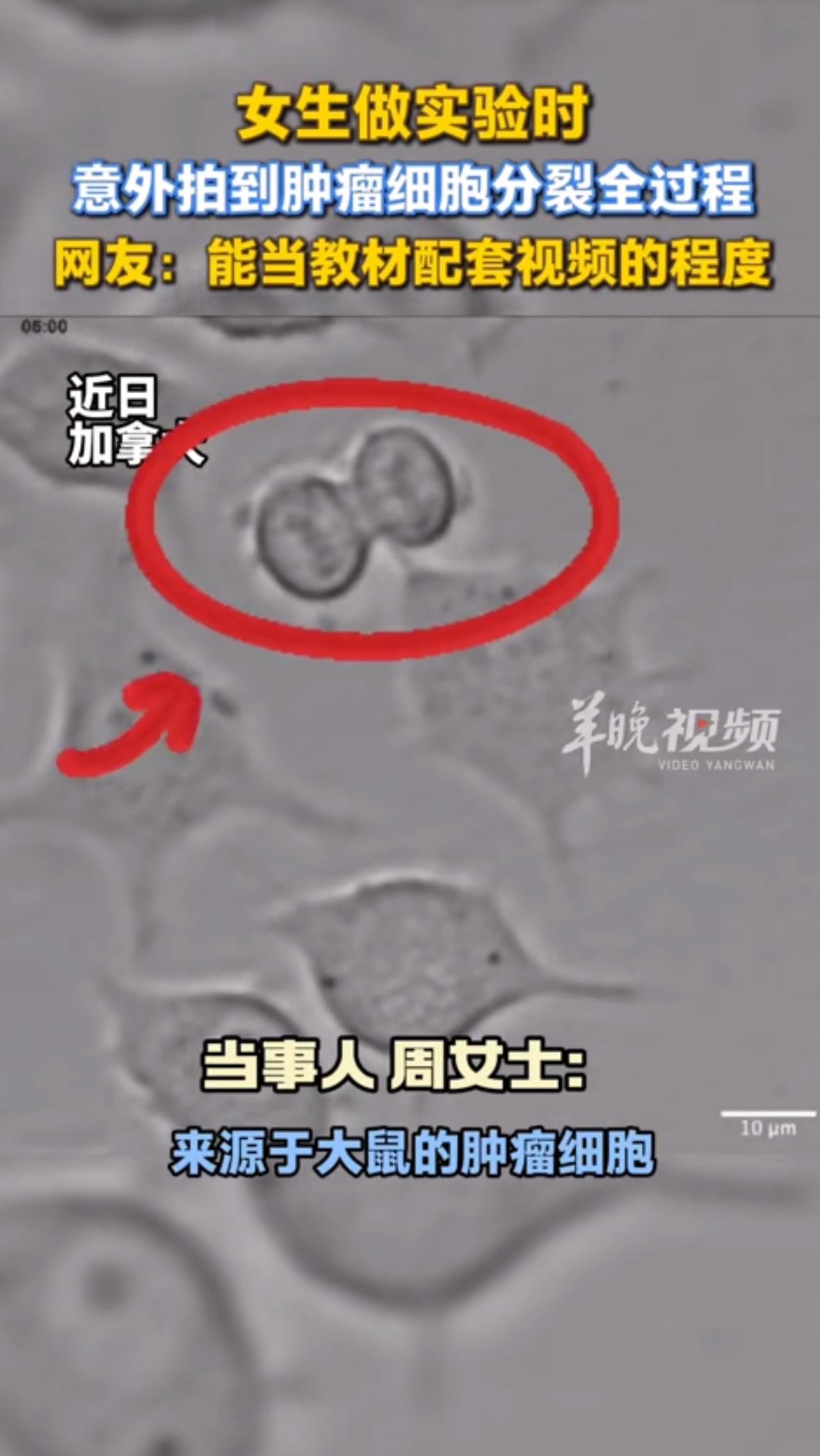 显微镜下的镜头原本对准着培养皿里静默的细胞群，加拿大实验室的周女士只是想记录些细