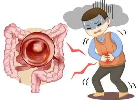 不想长肠息肉，做好这四件事。比你吃多少保健品都管用。今天在门诊上遇到一位患者，
