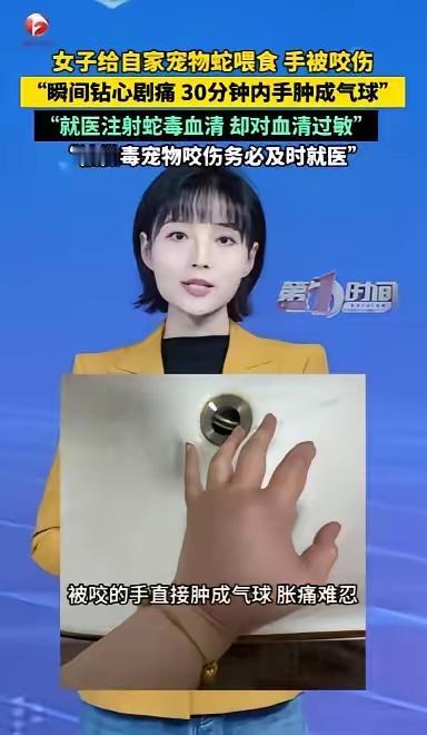 太离谱了！江苏一女生在家饲养了一条宠物猪鼻蛇，却因疏忽连续三四个星期没有给蛇喂食