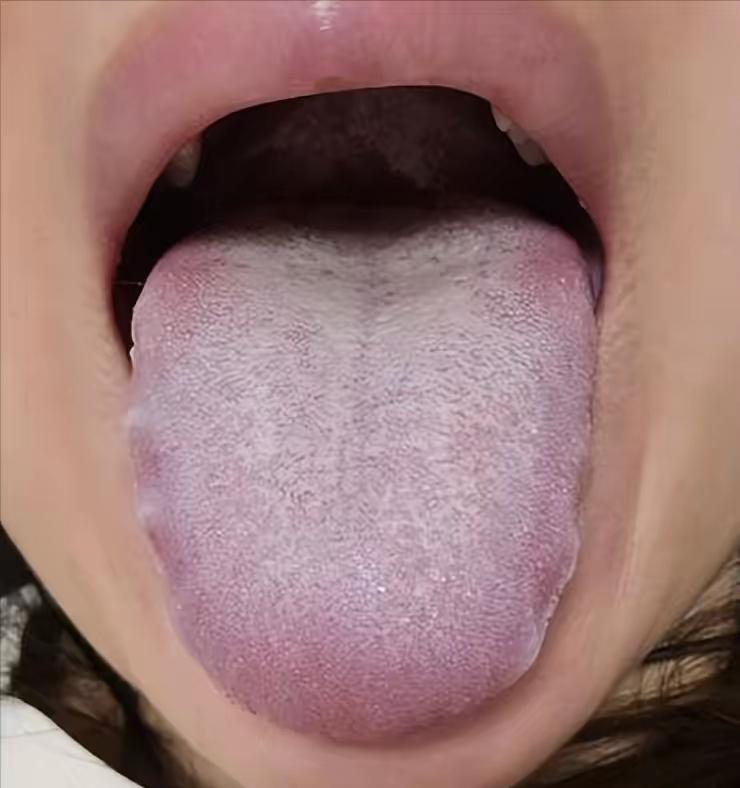 从描述来看，这类问题的核心是肝郁血瘀+脾虚湿盛，调理需“调心”与“用药”结合，单