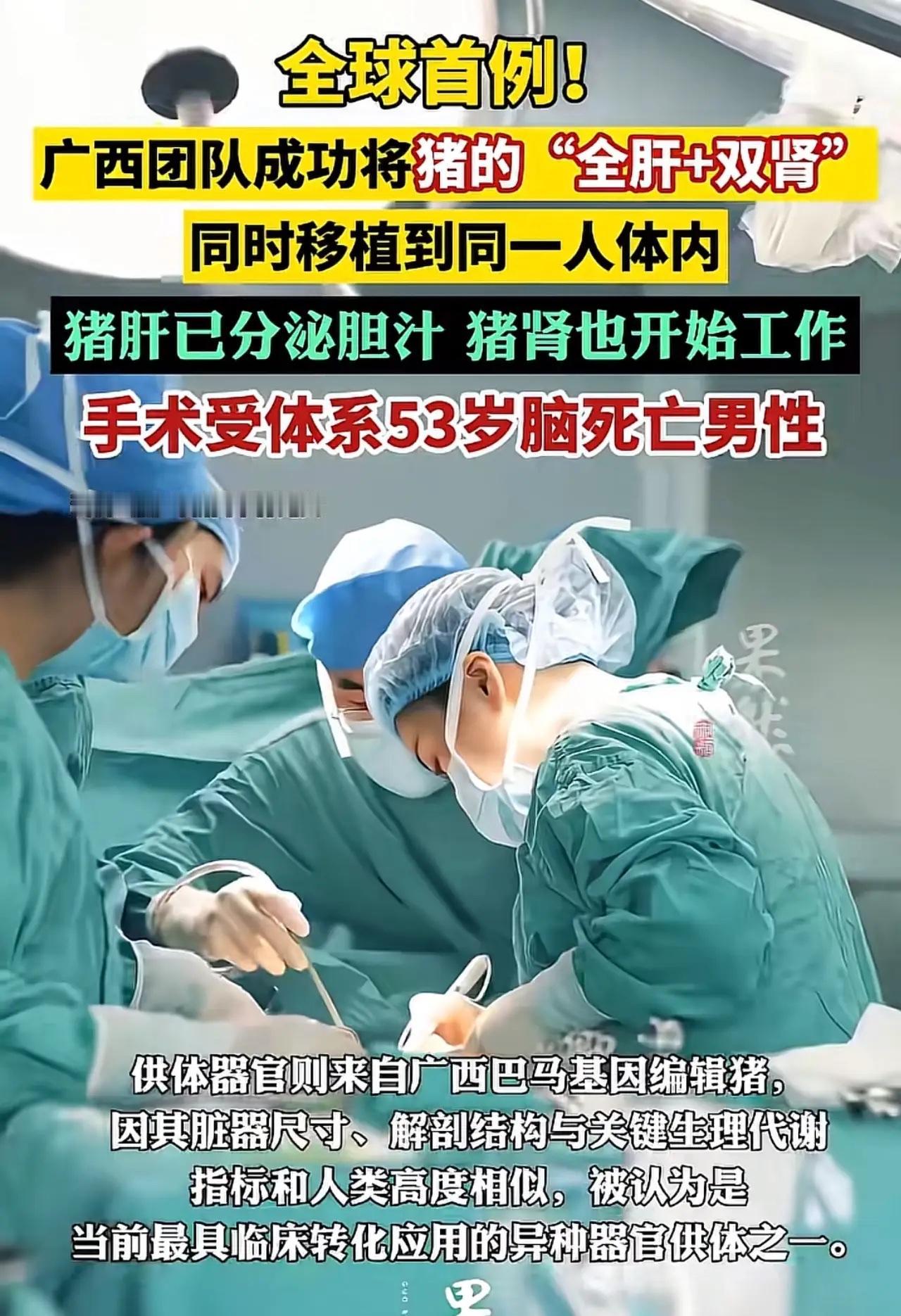 一位53岁脑死亡男士，经家属同意后，广西的医疗团队把经过基因改良的猪肝脏，双肾脏