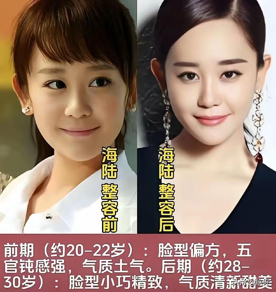 女明星们昔日对比，谁是你心中“整容后变化最大”的女星？张子萱的“大方承认”、