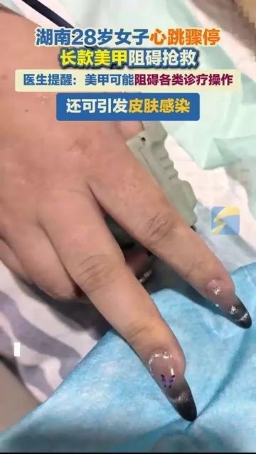 救命关头，美甲竟成“夺命障碍”！28岁女子心脏骤停，真相让所有女生警醒28岁