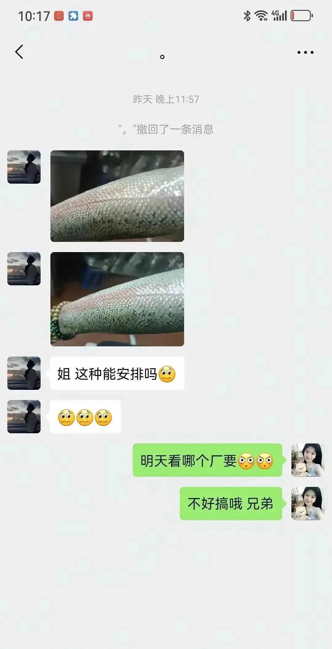 这种情况还能进厂打工吗