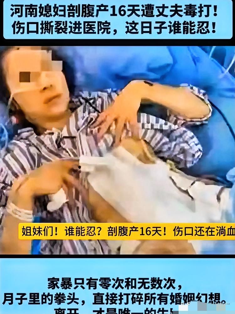 太窒息了！河南女子剖宫产术后仅16天，就因婴儿啼哭被丈夫往未愈的刀口上狠狠踹，耳