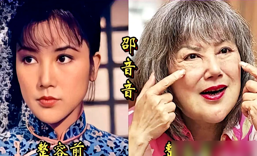 王鸥被骂了十年整容脸，最近开口就俩字：原谅。她说以前也气，后来想通了，嘴长别人身上，日子得自己过。记