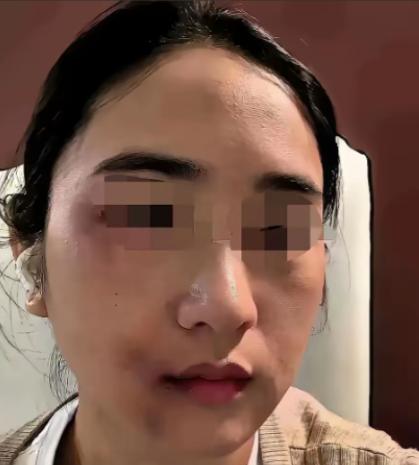丈夫家暴妻子近十年，刚动手打完妻子三天，自己就确诊肝癌晚期，家人逼迫女方拿出全部