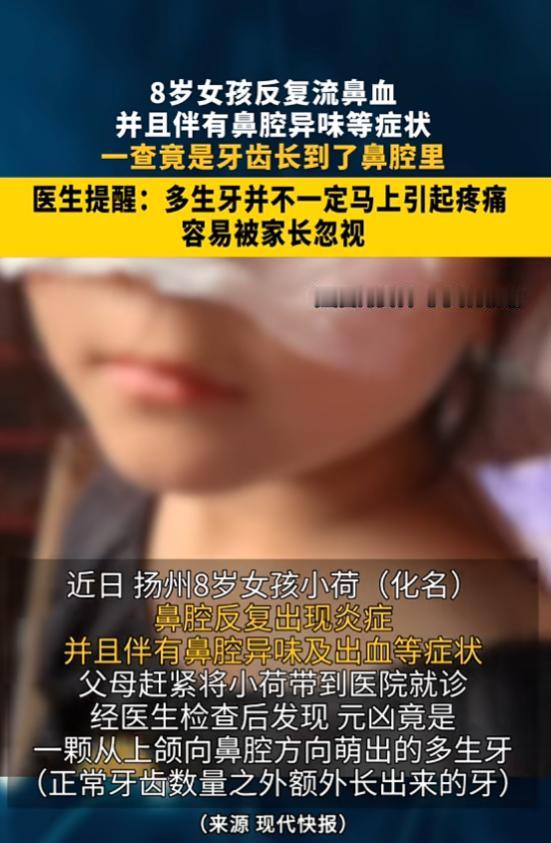 “家长要注意了！”7月8日报道，江苏扬州，一8岁女孩鼻腔反复出现炎症，还有异味和