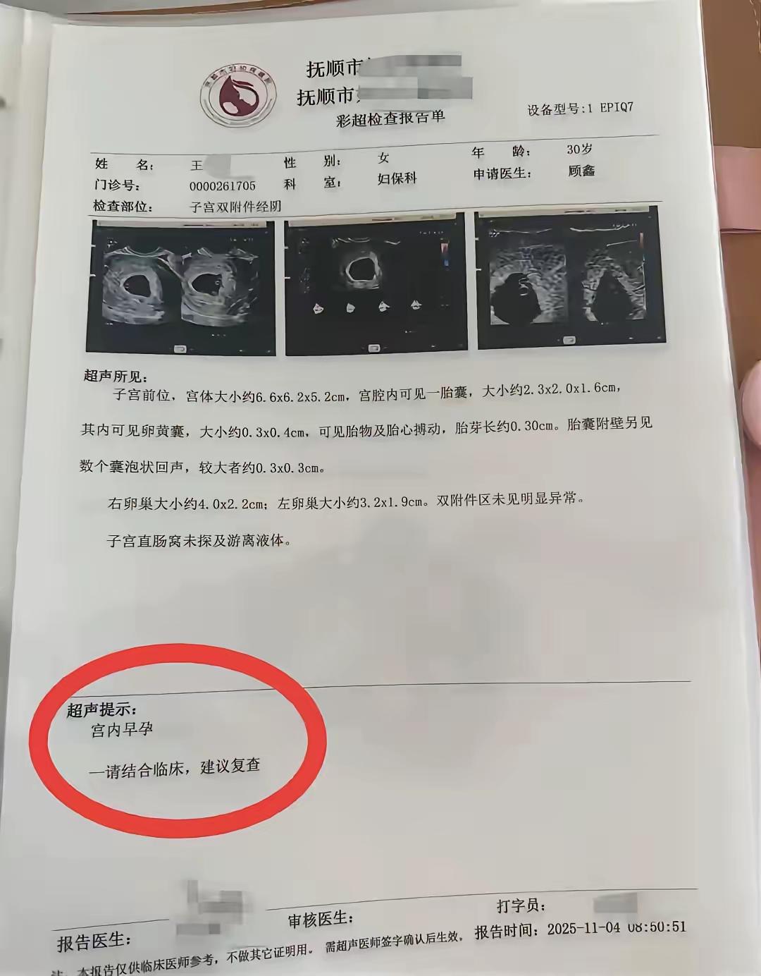 辽宁抚顺。王女士30岁了，怀孕16周。产检四次。第一次产检单胎，第二次产检双胎