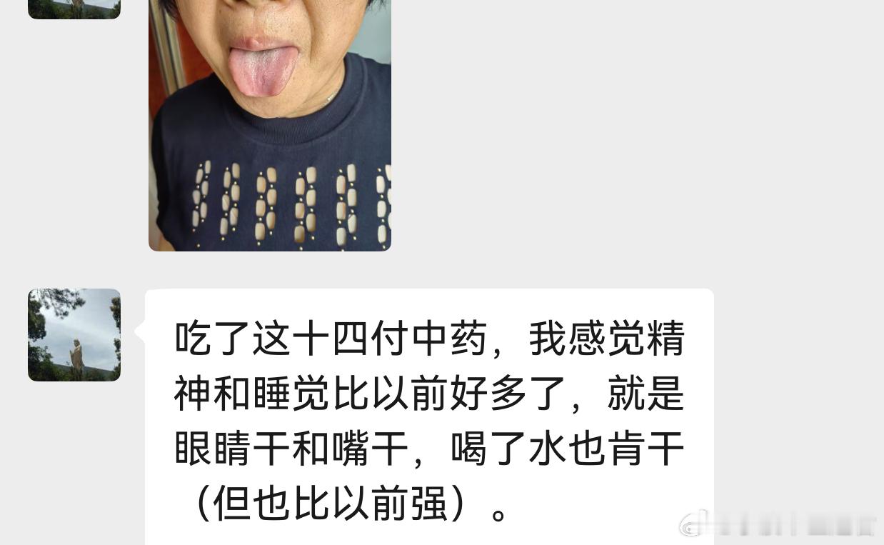 我表弟（姨姨的儿子）的大姑，63岁，今年春节我回老家，她去广西旅游了，没见着我。