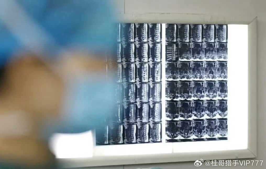 【5种炎症可能变成癌症】女子久坐便血半年后确诊癌症晚期多项流行病学研究表明，