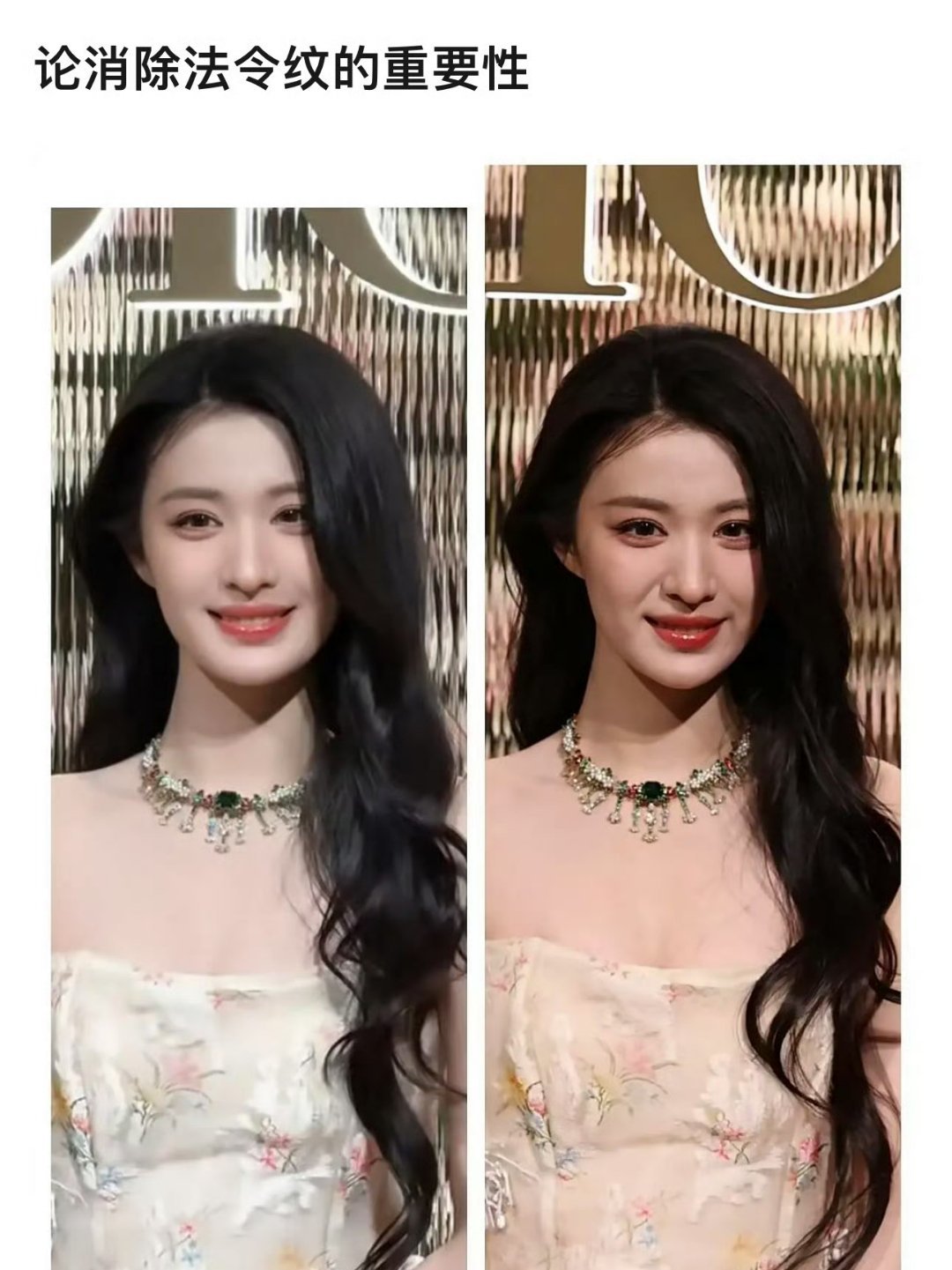 法令纹消除之后就不像真人，脸就感觉很僵。