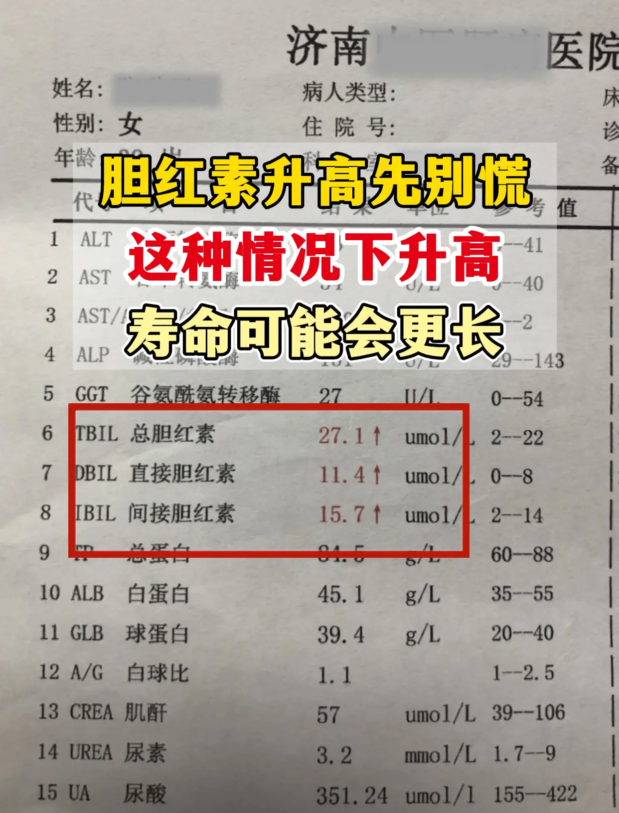 昨天一位济南本地的肝病患者拿着化验单着急找我，说最近复查胆红素都有点偏...