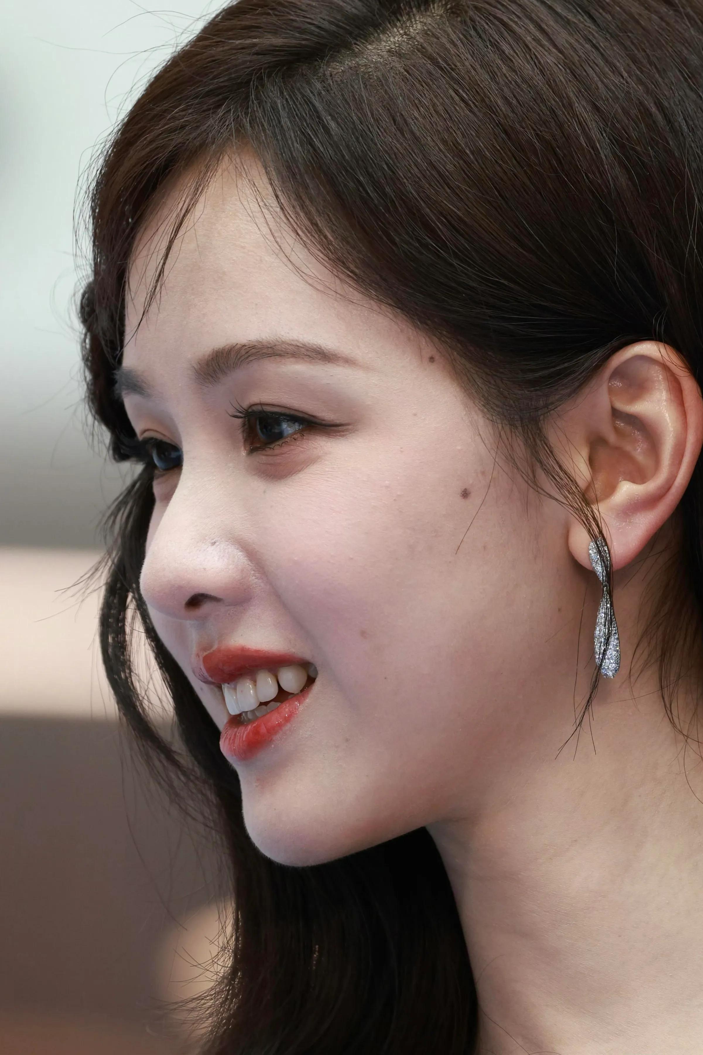 原来陈都灵的脸上这么多痣啊还以为她没有痣