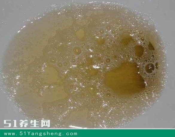 尿液是“粪臭味”, 你就危险了, 对照自检一下吧!
