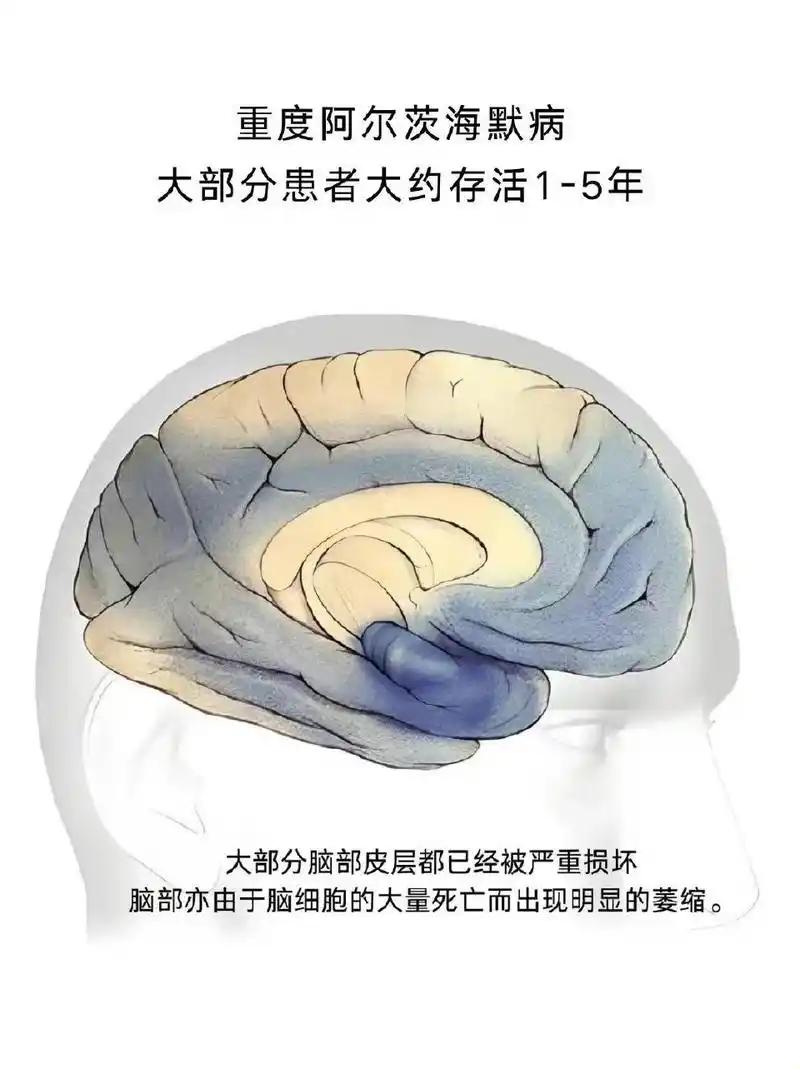 宽吻海豚也会患上类似人类阿尔茨海默病，藻毒素或是重要诱因 （信源：科普中国）