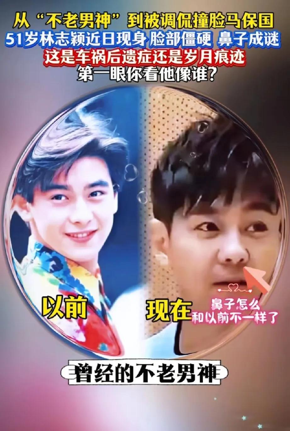 林志颖变老我能接受，变年轻也不意外，可我是真没想到…他现在居然和以前完全不一