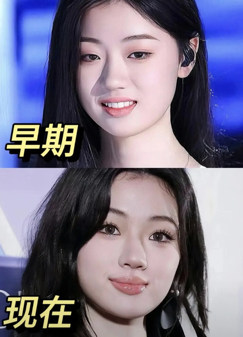 单依纯丰唇背后一定有高人指点她并非为了更好看，也不是迎合欧美市场，而是为了让