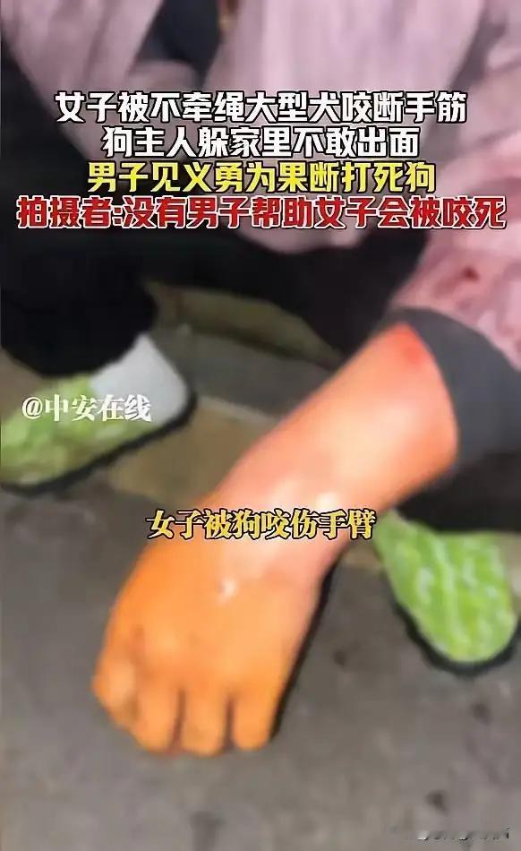 株洲惊魂一夜！女子被不牵绳黑背狂犬撕咬，手筋断裂血流如注，见义勇为小伙棍棒打死恶