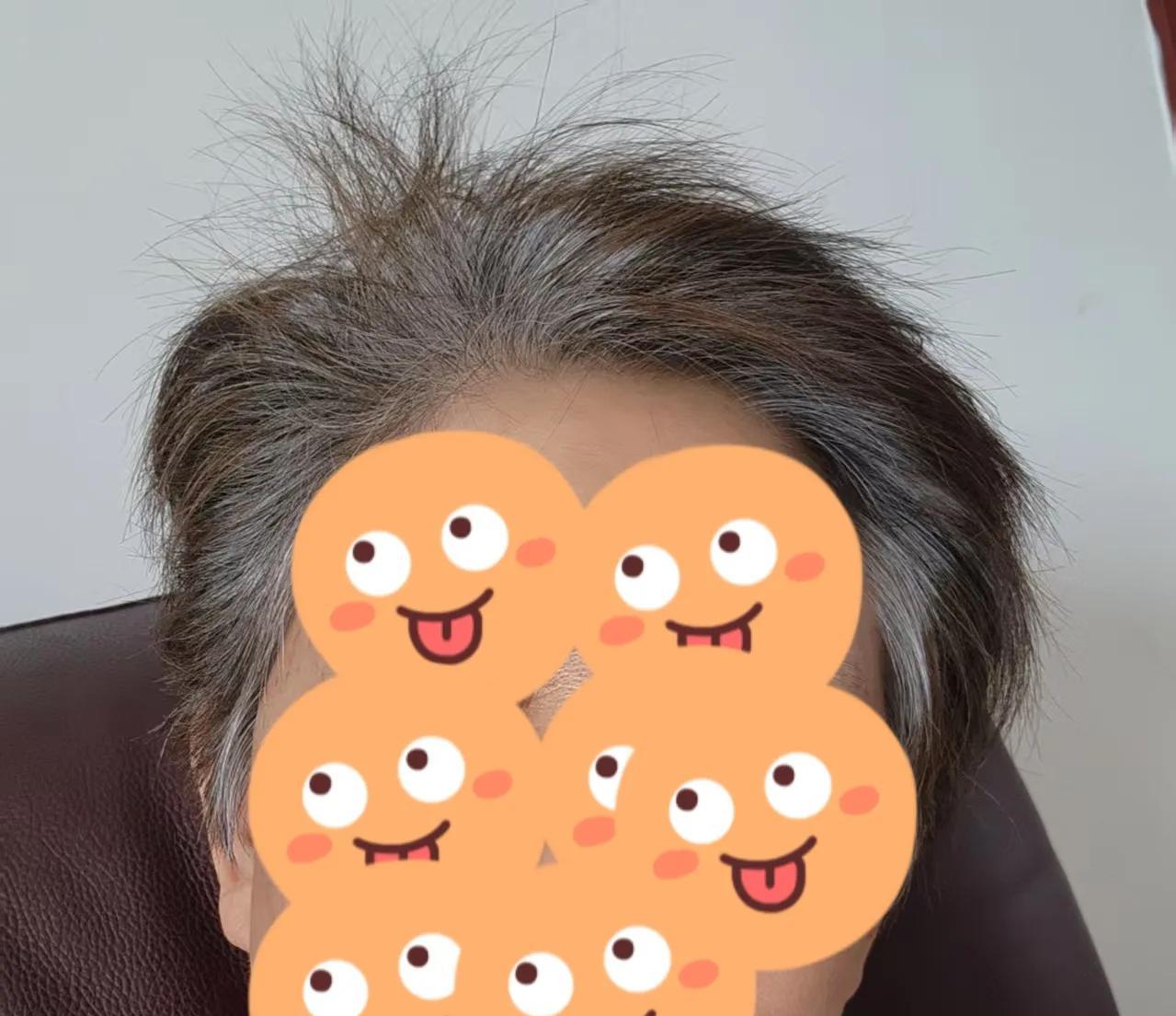 同事李姐上午给我发微信照片，打算以后头发不染了，李姐退休后一直染发，她感觉不染发