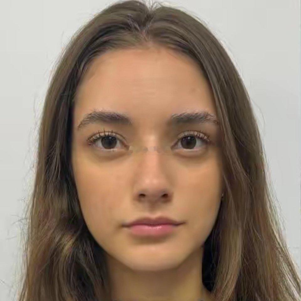 这个女孩做了嘴部整容手术，大家觉得怎么样？