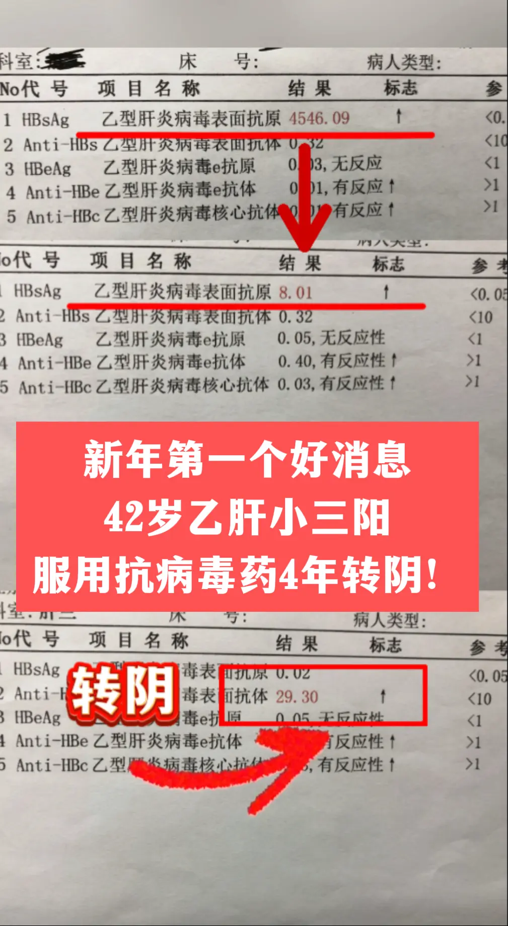 42岁的王先生，乙肝小三阳，吃了 4 年抗病毒药，今天复查，表面抗原转...