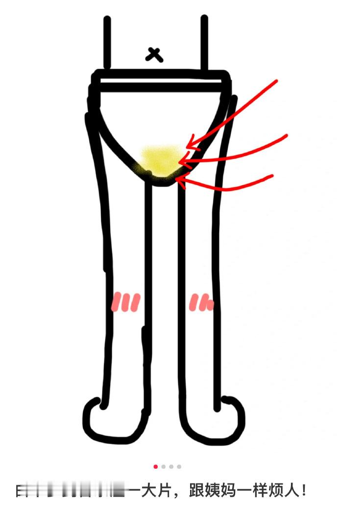 一个妇科冷知识