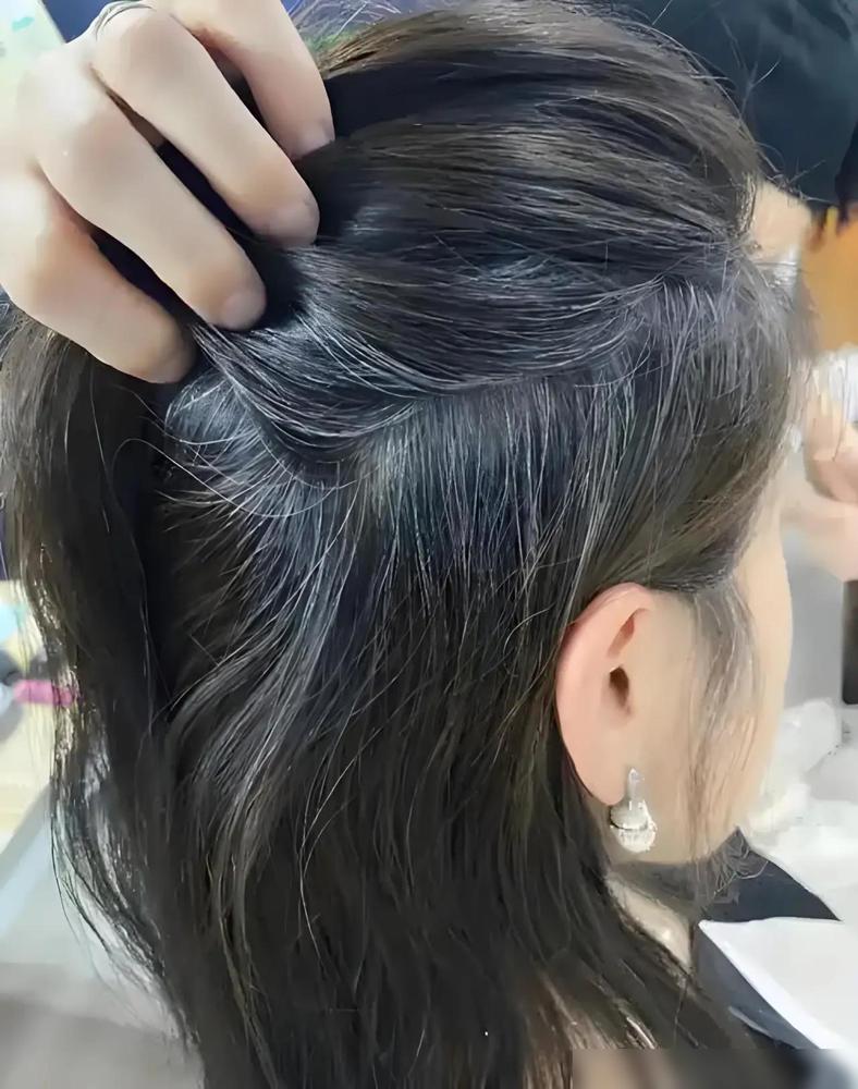 谁能想到，治好我“衰老焦虑”的特效药，竟然是老同学那一头比我更惨的白发。四十