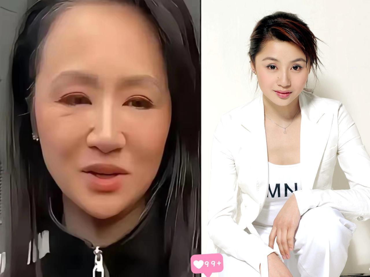 4岁儿子含泪劝停播，曹颖愣是没听！甲状腺癌术后才7天，脖子上还挂着引流管就