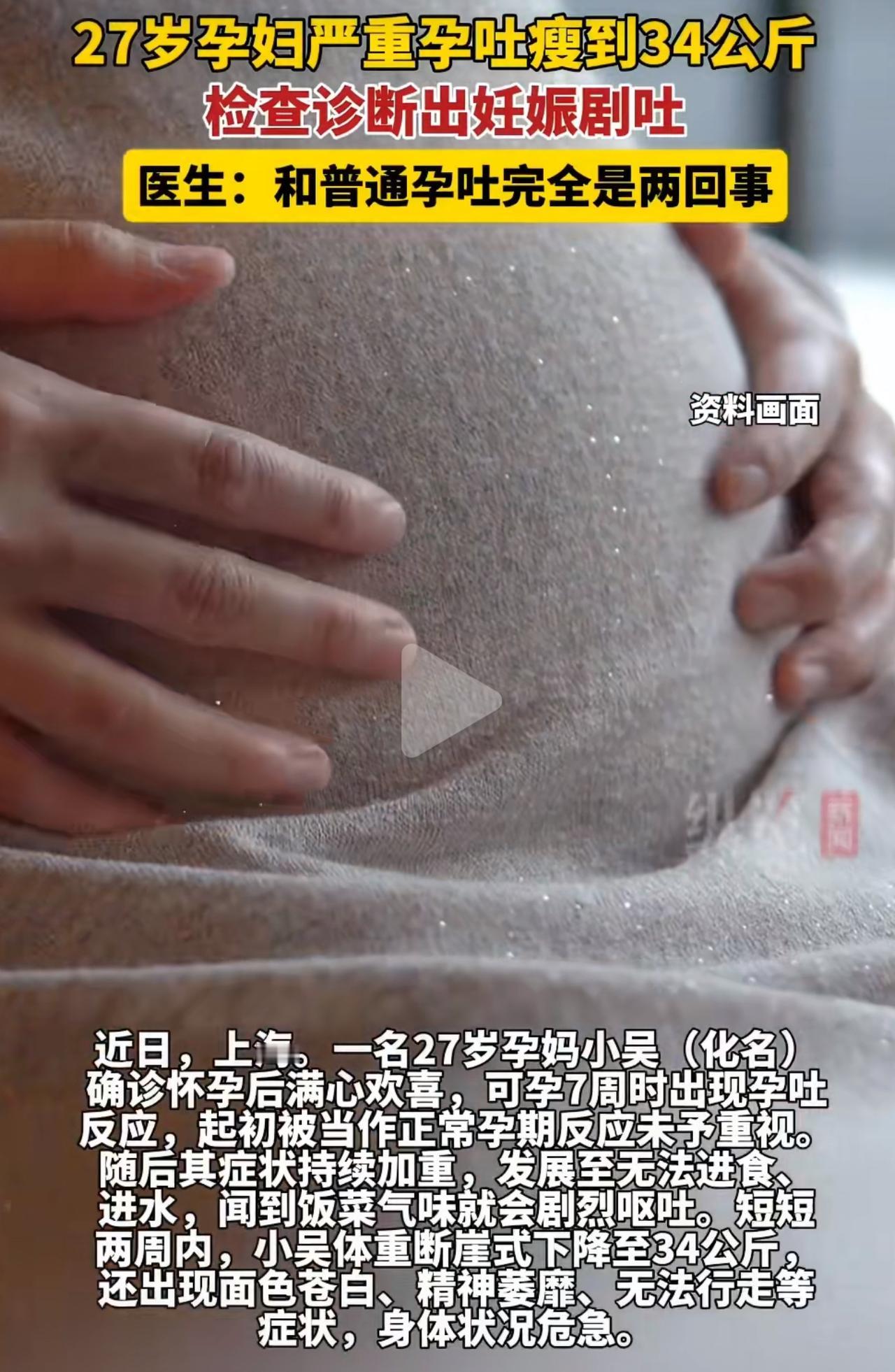 上海这位孕妈小吴，怀孕7周就开始吐，刚开始大伙都觉得是怀孕的正常反应，压根没放在