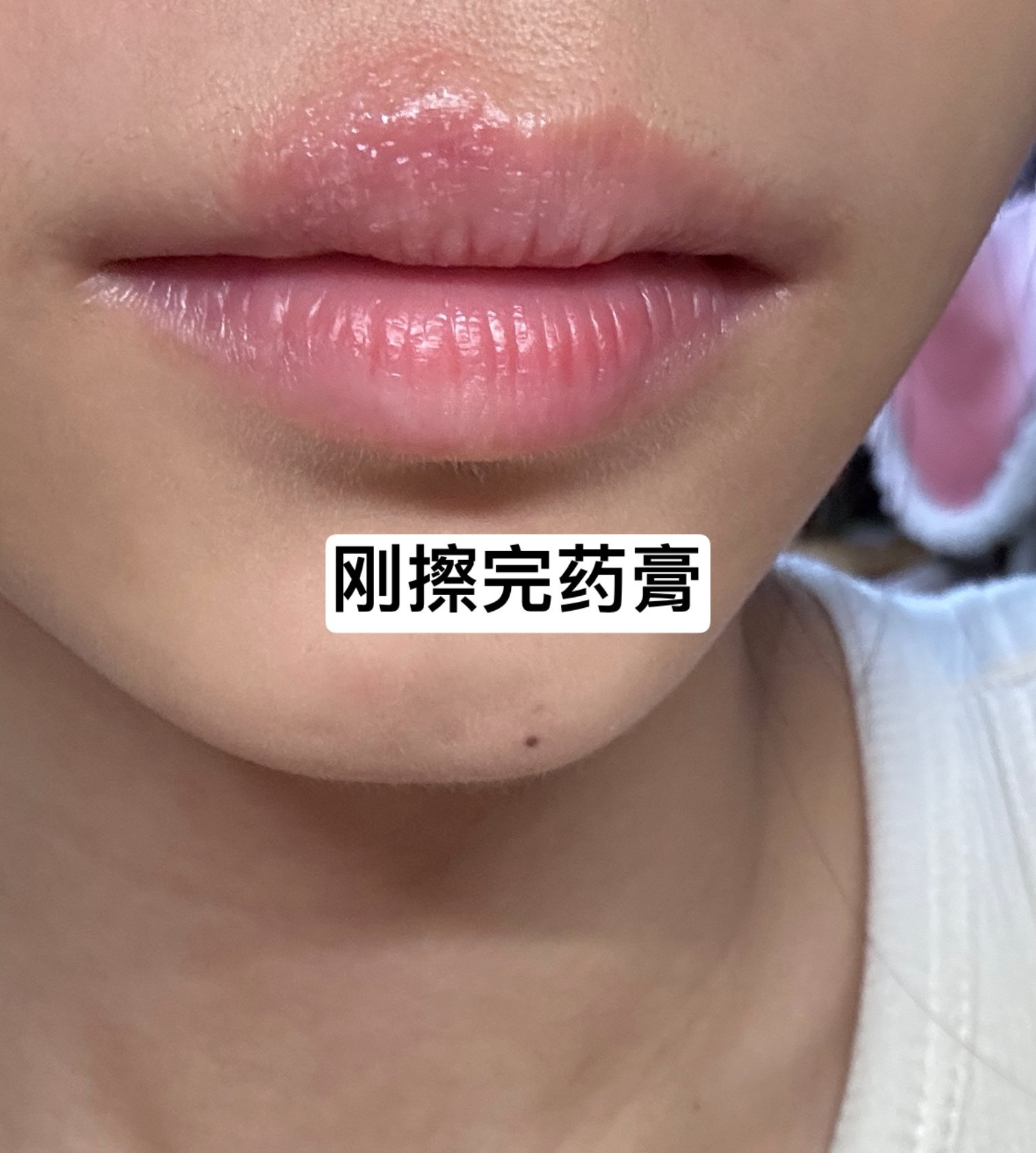 有人知情人知道我的嘴巴肿么了么……五一假期后半阶段开始的总感觉嘴巴上嘴唇那里好