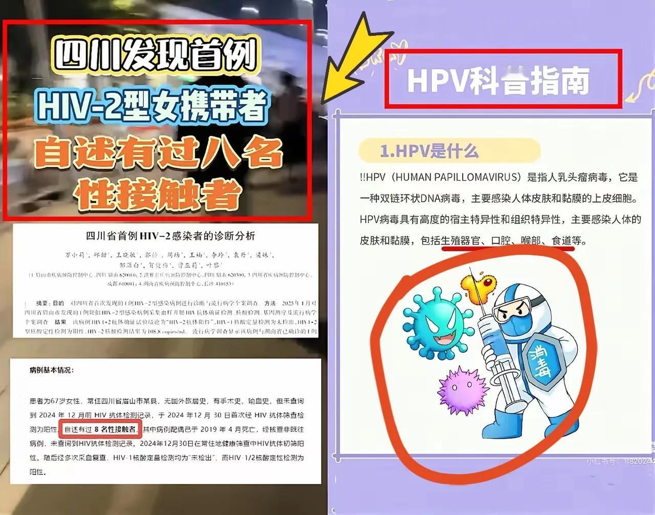 四川67岁阿姨查出HIV-2，这是四川首例，国内也很少见。这个病毒比常见的HI