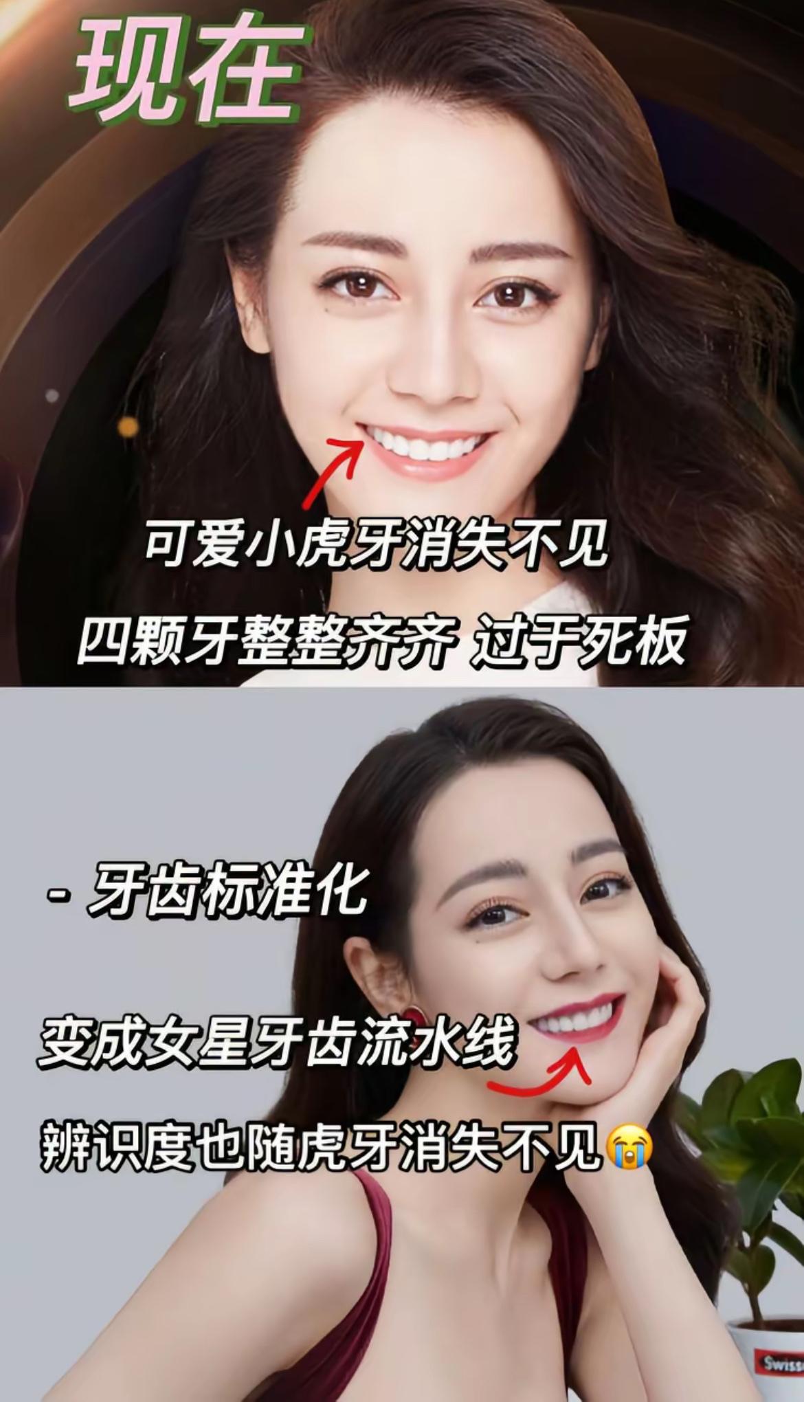 我好像知道热巴比以前显老的原因了，她的虎牙没有了！现在的热巴换了烤瓷牙，很精