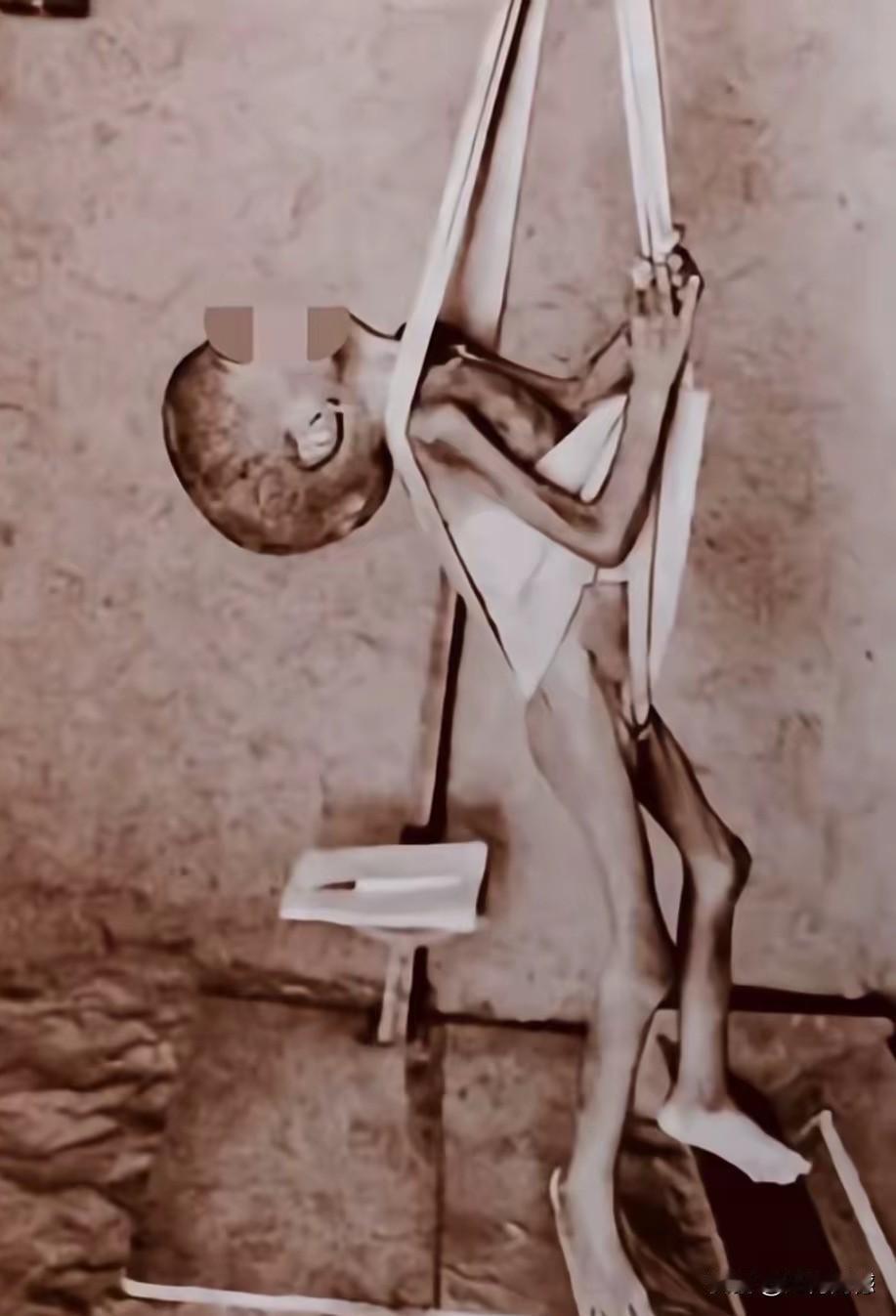 这是一招让人震惊的照片，照片中的这个孩子骨瘦如柴，不知道遭受了怎样的待遇，竟然瘦