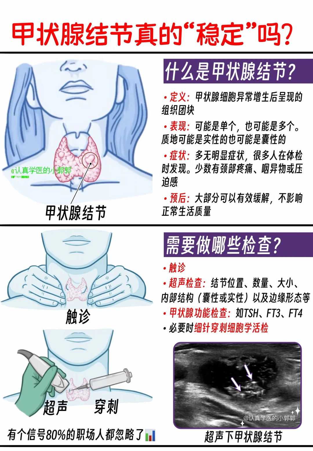甲状腺结节"稳定多年"？职场人别被骗！