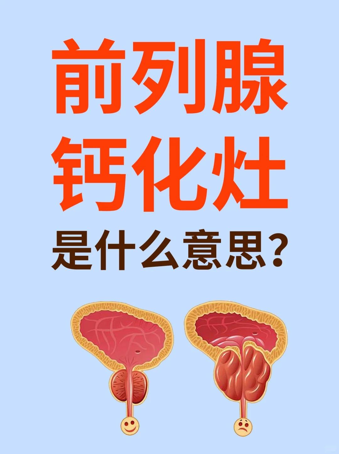 前列腺钙化灶是什么意思？