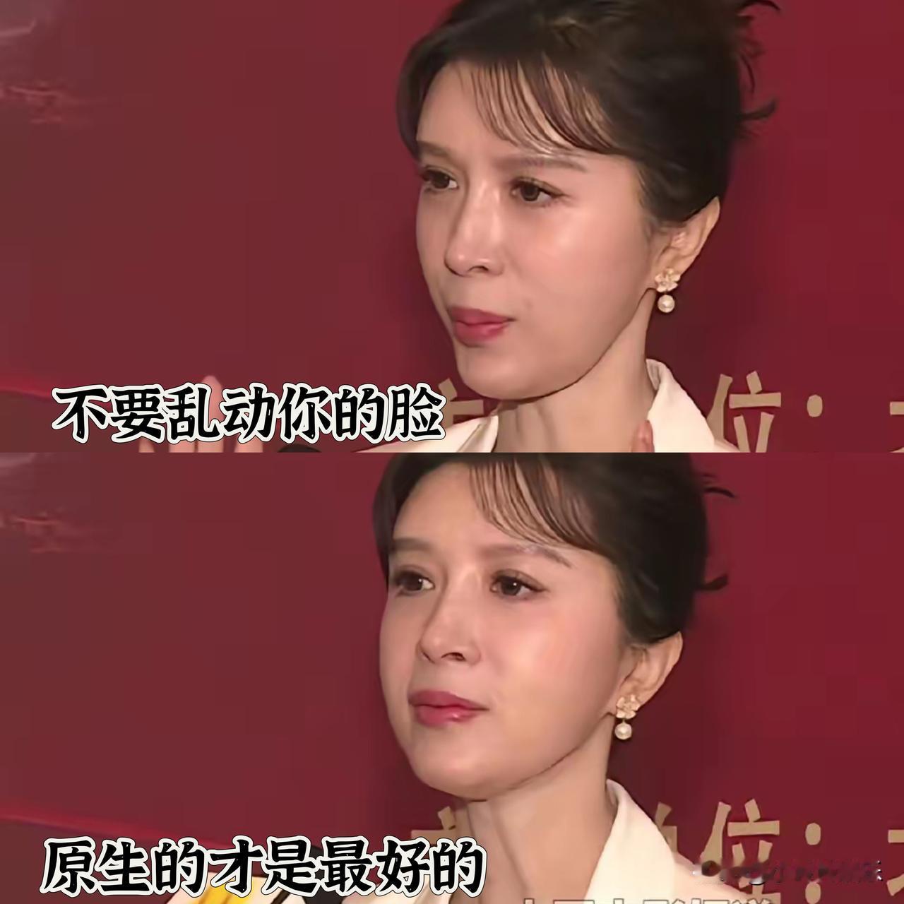 感觉金巧巧不太对劲51岁的人了尖下巴、高鼻梁、烤瓷牙、苹果肌这些整容的痕