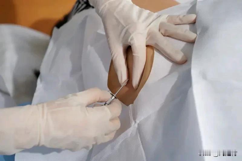 女生开电热毯整夜没翻身得压疮女生整夜开电热毯未翻身患压疮天冷时，开着电热毯睡