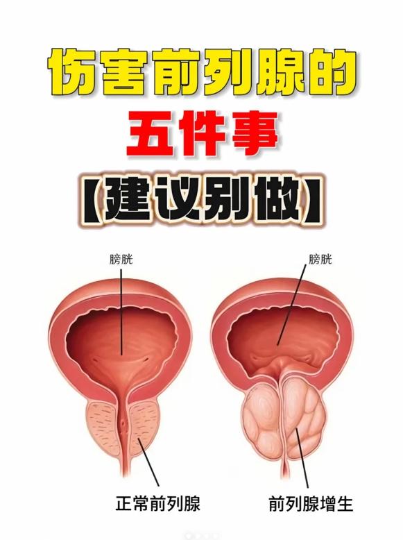 护腺必看：这5件事超伤前列腺，趁早避开