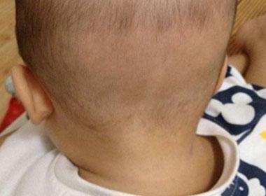 孙子出了百天, 产妇就被逼着去打工, 回来看见孩子脑袋两人疯了