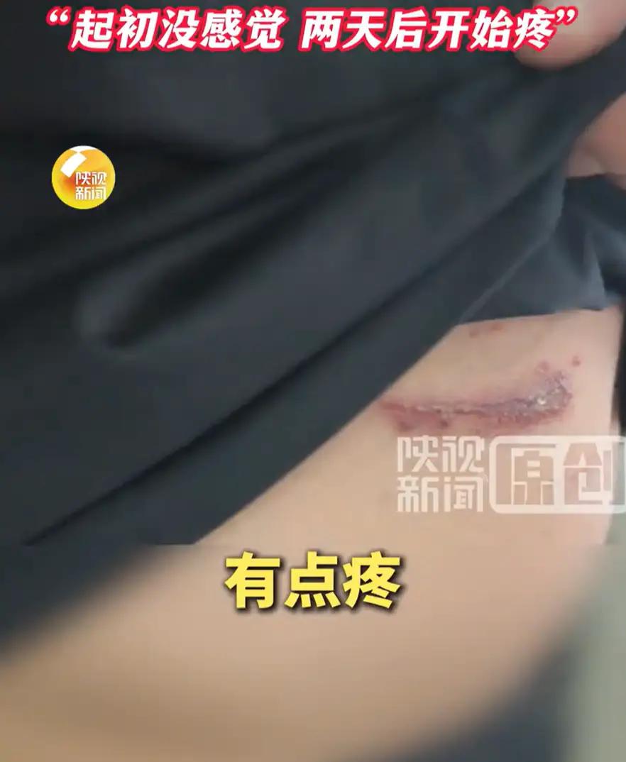 陕西西安，男子在家休息时，突然觉得肚皮有点痒，就随手抓了几下，可没多久皮肤就出了