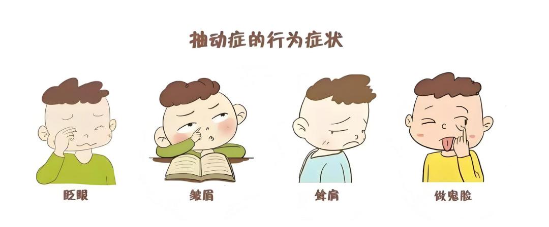 夏季抽动高发，这3个常见原因，千万要避开！夏天到了，有些孩子抽动症会反复——