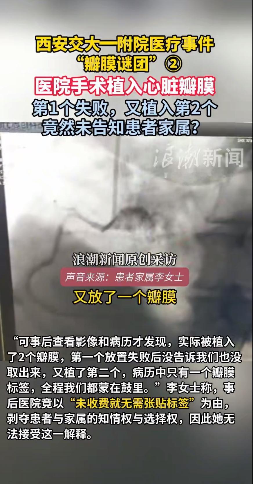西安交大一附院的一则新闻炸开了锅：一个进价仅3万多元的心脏瓣膜，竟向患者收取28